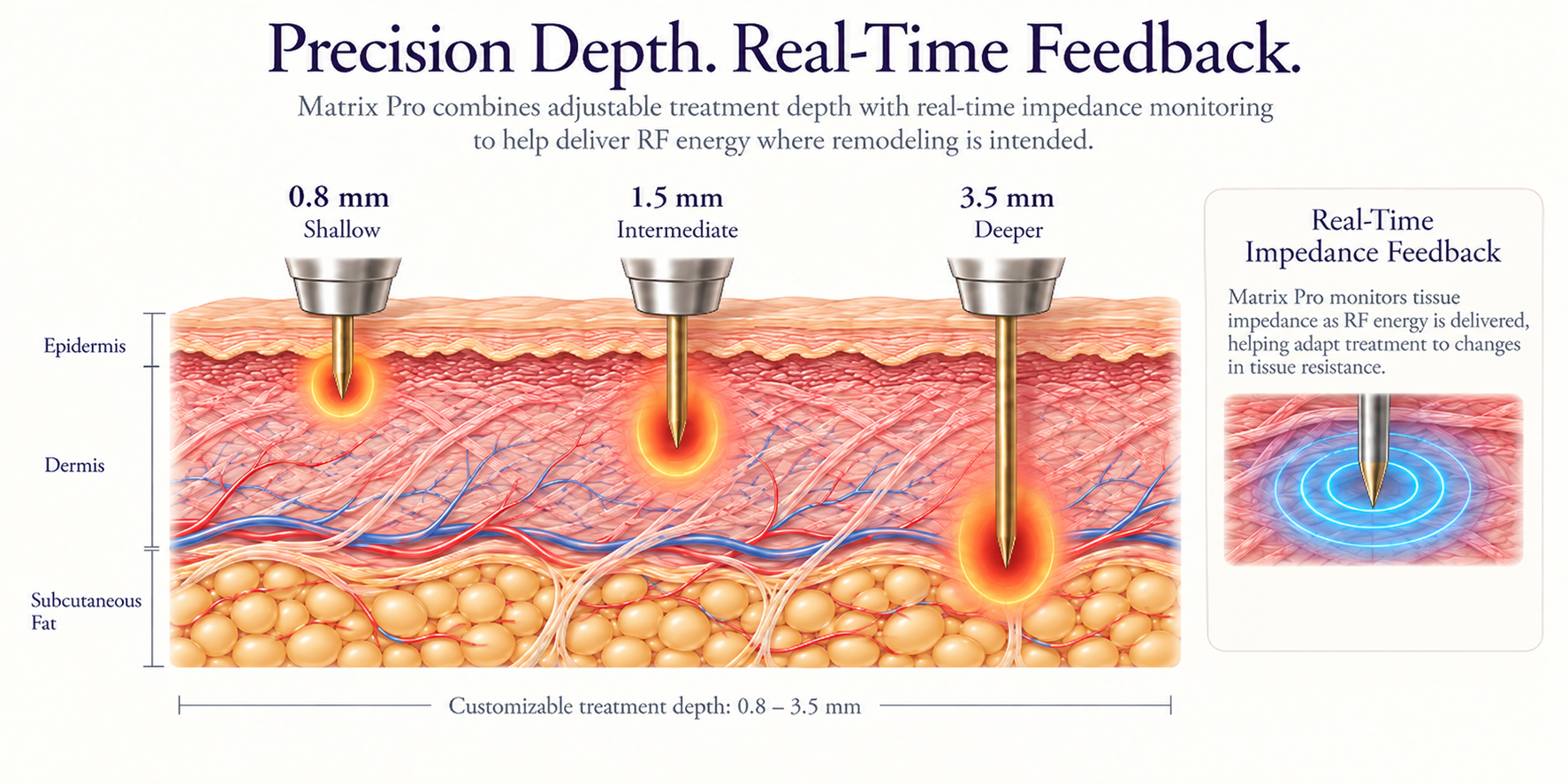 Educational illustration showing Matrix Pro RF microneedling at shallow, intermediate, and deeper customizable depths with real-time impedance feedback.